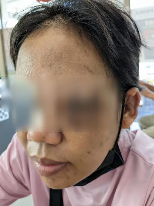 Bekerja Merawat Putra yang Stroke, PMI Ini Malah Menerima Penyiksaan yang Tidak Manusiawi