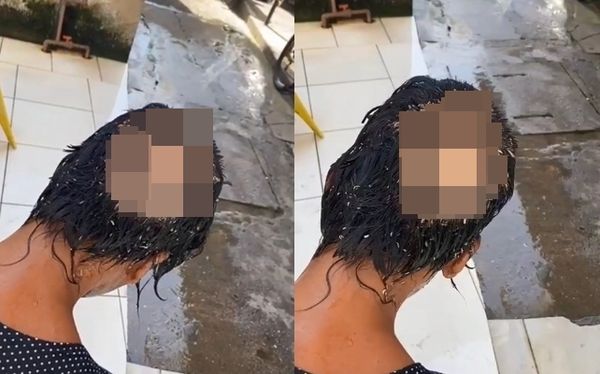 Kepala Wanita Ini Digerogoti Belatung sampai Tulang Tengkoraknya Terlihat